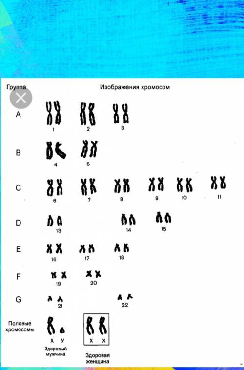 Перед вами два возможных кариотипа человека. определите какой из них принадлежит женщине. как называ