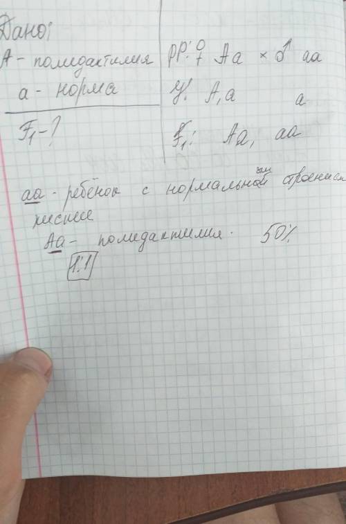 Учеловека аллель полидактилии( многопалость) доминирует над нормальной пятипалой рукой. в семье, гле