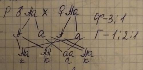 Детей этой пары? 3) какова вероятность рождения в семье ребёнка с тяжёлой формой анемии (в %)? 4) ка