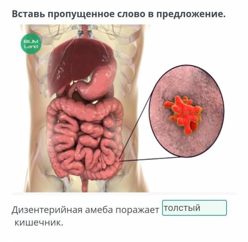 Инфекционные заболевания и меры их профилактики: амебная дизентерия, фитофтороз, холера, дифтерия, л