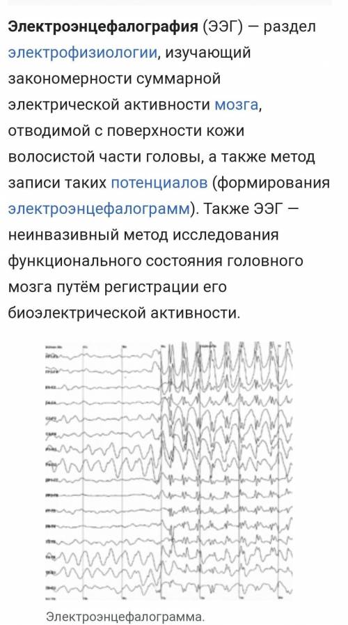 Электроэнцефалография в переводе с греческого? ​