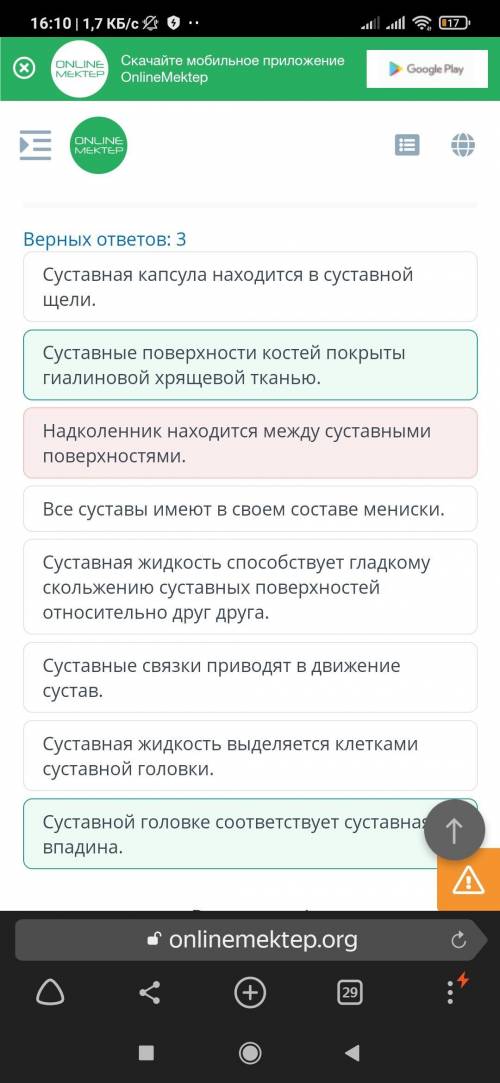 Главными компонентами сустава являются суставная головка и суставная образованные костями, входящими