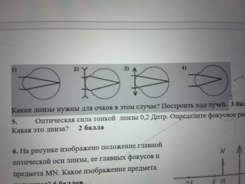 Какая из представленных на рисунке схем хода параллельного пучка лучей соответствует случаю близорук