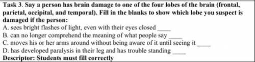 Say a person has brain damage to one of the four lobes of the brain (frontal, parietal, occipital, a