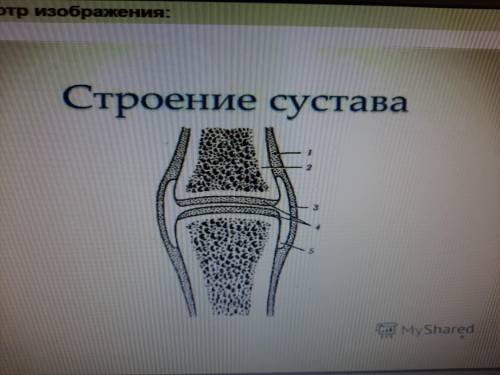 Выберите признаки, характерныедля структуры сустава под номером 4 Варианты ответа(возможно несколько