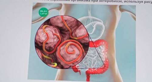 Определите правильную последовательность заражение организма при энтеробиозе .Используя рисунок •отк