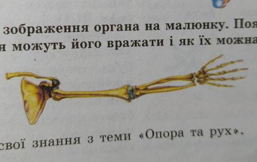 розгляньте зображення органу на малюнку поясніть які захворювання можуть його вражати і як їх можна