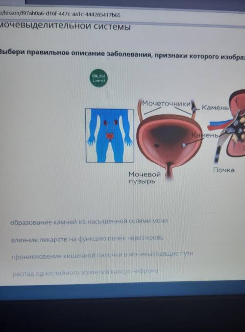 Выбери правильное описание заболевания, признаки которого изобрадены на карттнке.​