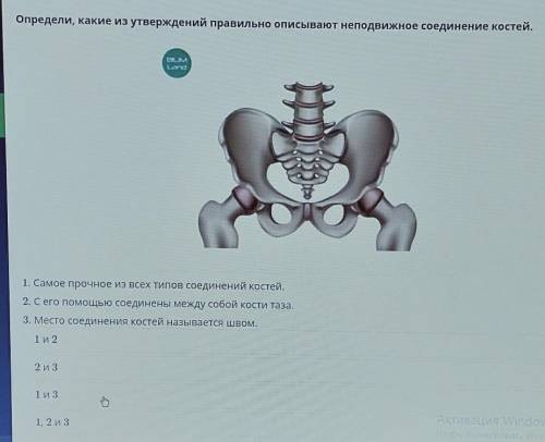 Определи, какие из утверждений правильно описывают неподвижное соединение костей.​