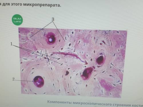 Выбери обозначения для этого микропрепарата.