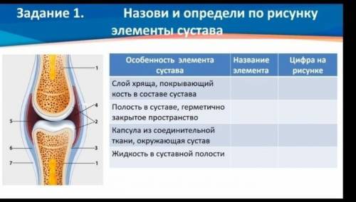 Назови и определи по рисунку элементы сустава ​