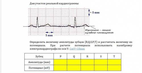 Определить величину амплитуды зубцов (R,Q,S,P,T) и рассчитать величину их потенциала. При расчете по