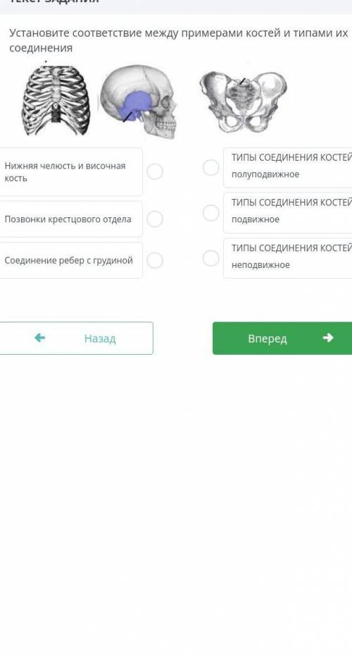 ТЕКСТ ЗАДАНИЯУстановите соответствие между примерами костей и их типами соединения​