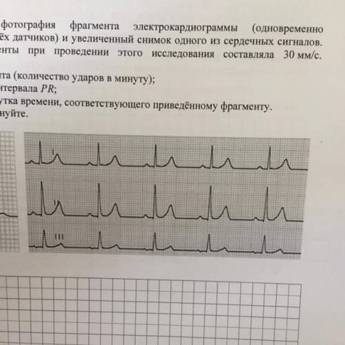 Электрокардиография (ЭКГ) один из важных методов исследования работы сердца Принцип работы аппарата