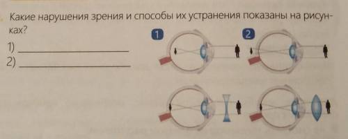 Какие нарушения зрения и их устранения показаны на рисунках? ​