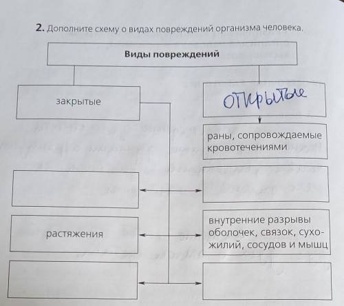 ОТ нормально, не просто : растяжения,вывехи,если можно то так:закрытыерастяжения Открытыераны сопров