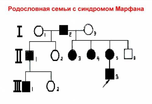 1. Провести генеалогический анализ по синдрому Марфана? 2. Определите тип наследственности признака?