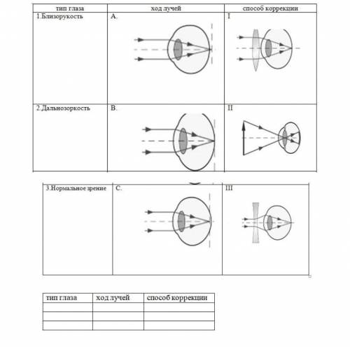Установите соответствие между типом глаза, ходом лучей в них и коррекции изображения.
