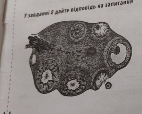 Назвіть орган жіночої статевої системи , зображений на малюнку , та вкажіть його функції ​