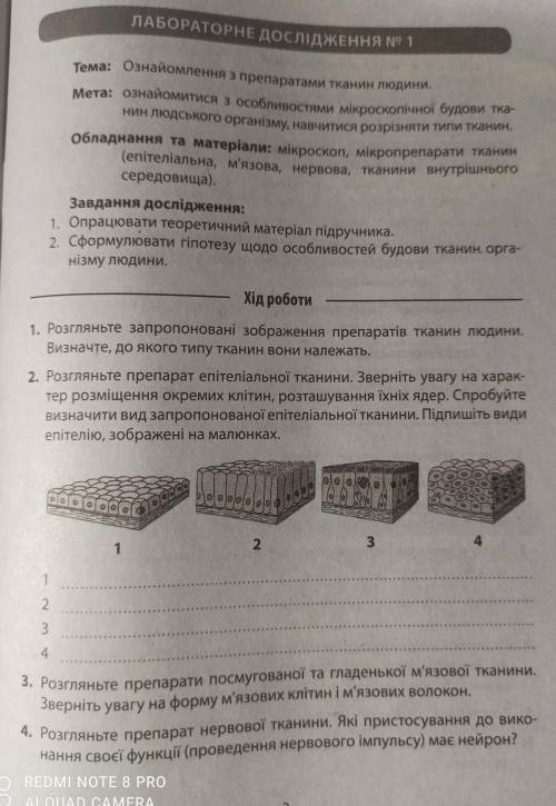 Лабораторне дослідження 1 Ознайомлення з препаратами тканин людини , очень ,