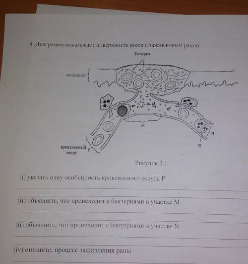 (і) указать одну особенность кровеносного сосуда Р (ii) объясните, что происходит с бактериями в уча