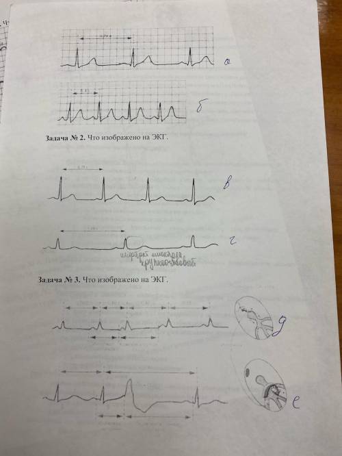 Что изображено на этих Экг Задача №1,2,3 и рассказать немного
