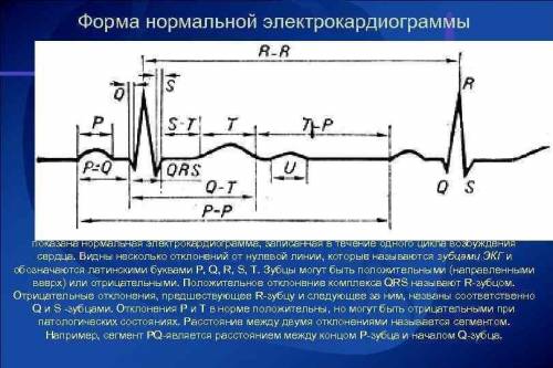 Что означают P, Q, R, S, T?​