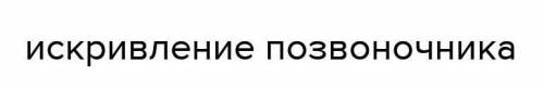 1. Какие негативные аспекты использования компьютера вы знаете?​