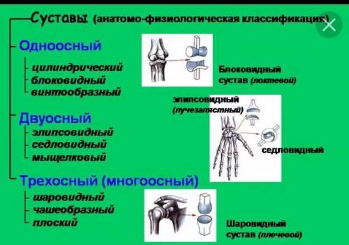 Нужны знающие биологию люди! Дайте характеристику суставу: