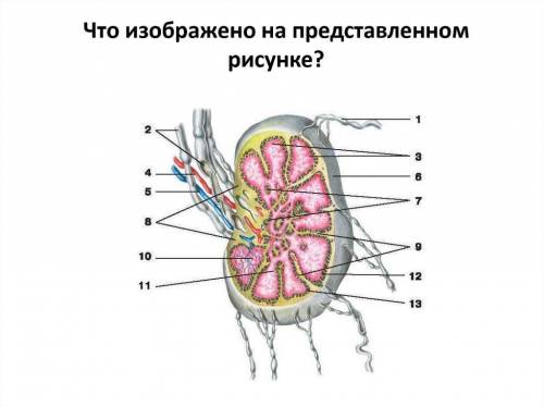 Сделайте обозначение к рисунку «Тимус в разрезе»