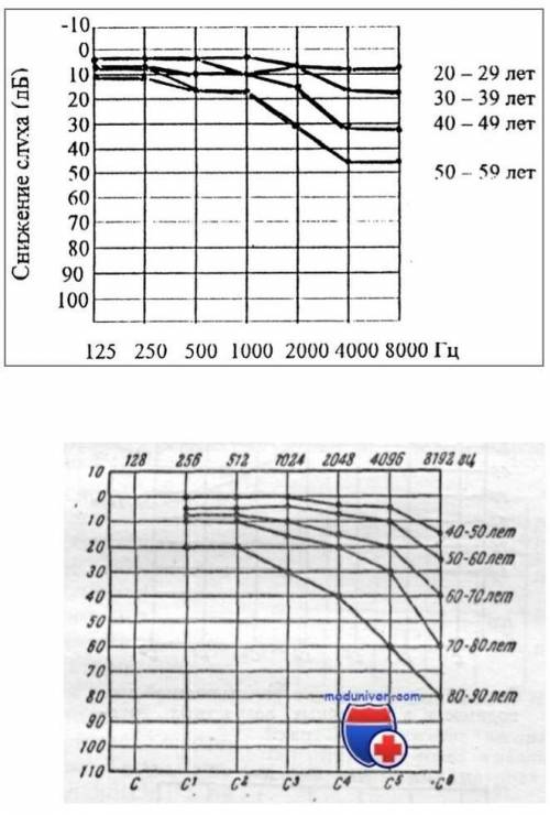 Основываясь на приведенном графике, объясните, почему при снижении слуха с возрастом человек хуже ра
