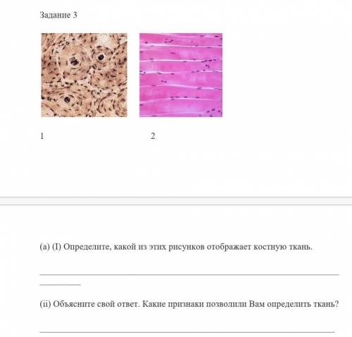 Задание 3 1 2(a) (I) Определите, какой из этих рисунков отображает костную ткань.___________________