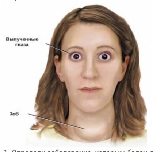 Представь, что ты работаешь врачом-эндокринологом, и к тебе на приём пришёл этот пациент. 1. Определ