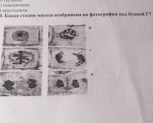 Какая стадия митоза изображена на фотографии под буквой Г​