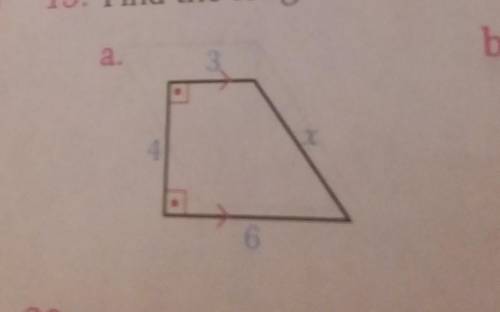 Find the lenght of x in trapezoid.​