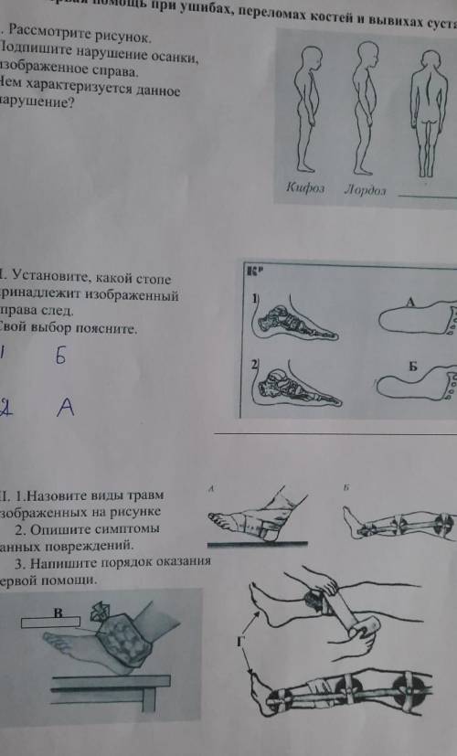 2020 ушибы, вывихи.docТема: Первая при ушибах, переломах костей и вывихах суставовI. Рассмотрите рис