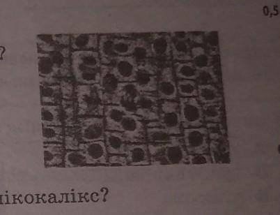 Який метод мікроскопії дозволяє побачити подане зображення? А) електронної мікроскопії Б) світової м