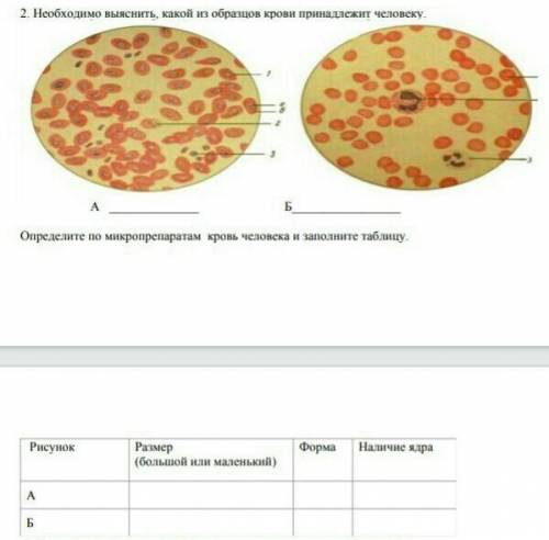 Необходимо выяснить какой из образцов крови принадлежит человеку у меня сор​