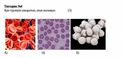 Қан түрлерін ажыратып атын жазыңыз.​