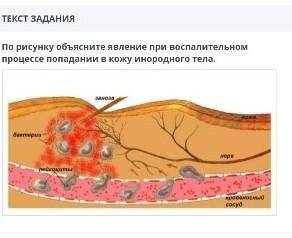 ТЕКСТ ЗАДАНИЯ По рисунку объясните явление при воспалительном процессе попадании в кожу инородного т