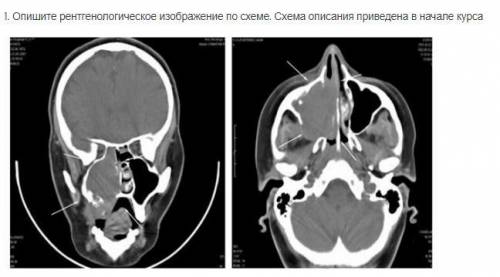 Кому не сложно выполните задание по схеме. Задание на фото Вот сама схема: 1. Объект исследования (в