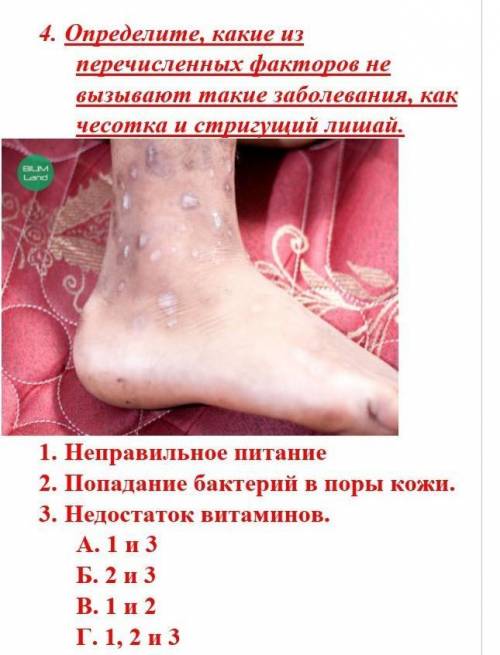 4. Определите, какие из перечисленных факторов не вызывают такие заболевания, как чесотка и стригущи