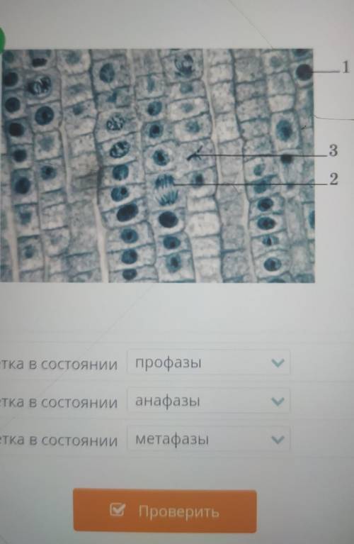 Определи фазы жизненного цикла данных клеток.​