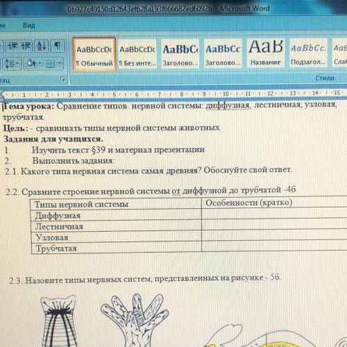 22. Сравните строение нервной системы от диффузной до трубчатой