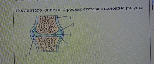 Опиши строение суставов по рисунку.​