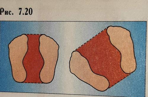 ОТВЕТИТЬ! 1..На рисунке 7.20 изображены два варианта положение стоп человека. Какой из них принадлеж