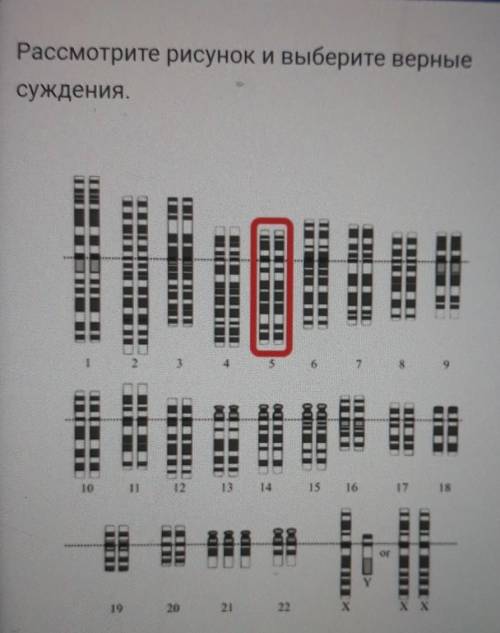 1. На рисунке представлен нормальный набор хромосом, характерны для клетки желудка человека 2. На ри