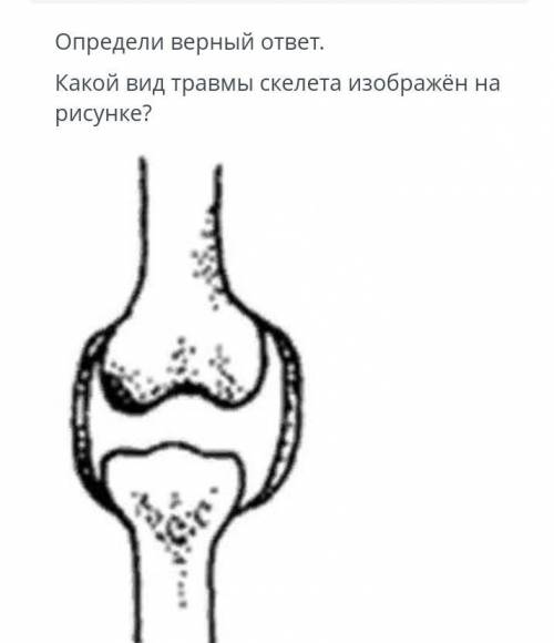 Верных ответов :11)Вывих 2) Перелом кости 3) Трещина кости 4) Растяжение связок ​