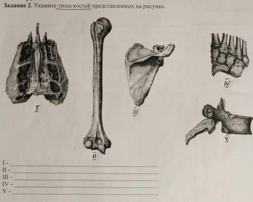Укажите типы костей представленных на рисунке​