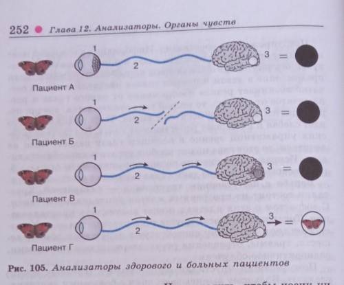 Рассмотрите рисунок 105. Укажите,у кого из пациентов зрение нормальное и какими нарушениями зрения с